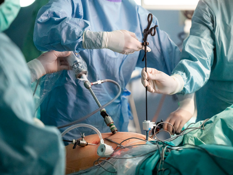 Gefäßchirurgie OP