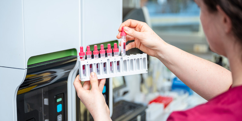 Mitarbeiterin des Zentrallabors beim Bestücken einer Maschine mit Blutproben